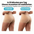 MAWIJ® Chirp™ | Cellulite-Massage für zu Hause